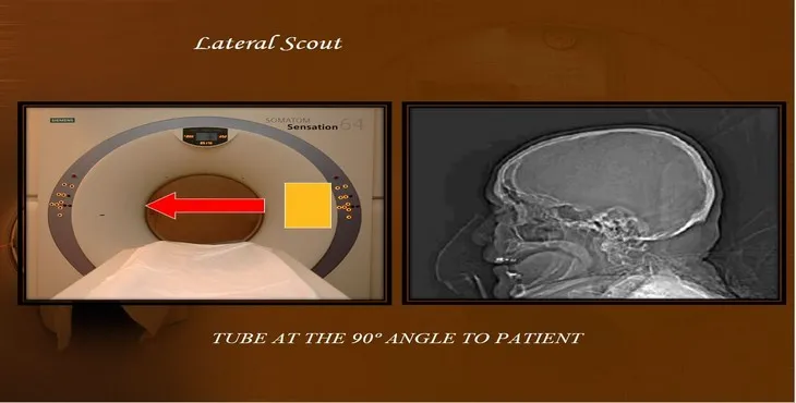 دانلود پاورپوینت توموگرافی کامپیوتری