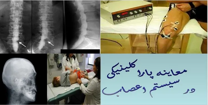 دانلود پاورپوینت معاینه پاراکلینیکی در سیستم اعصاب
