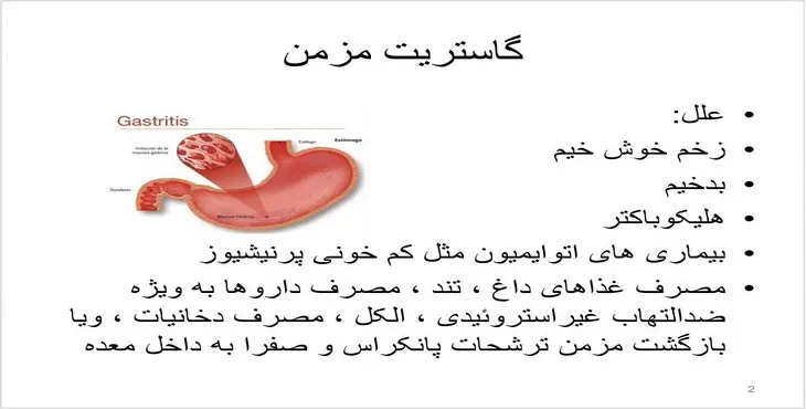 دانلود پاورپوینت گاستریت