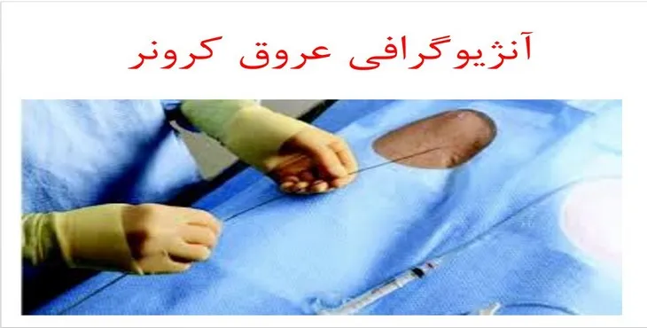 دانلود پاورپوینت آنژیوگرافی عروق کرونر